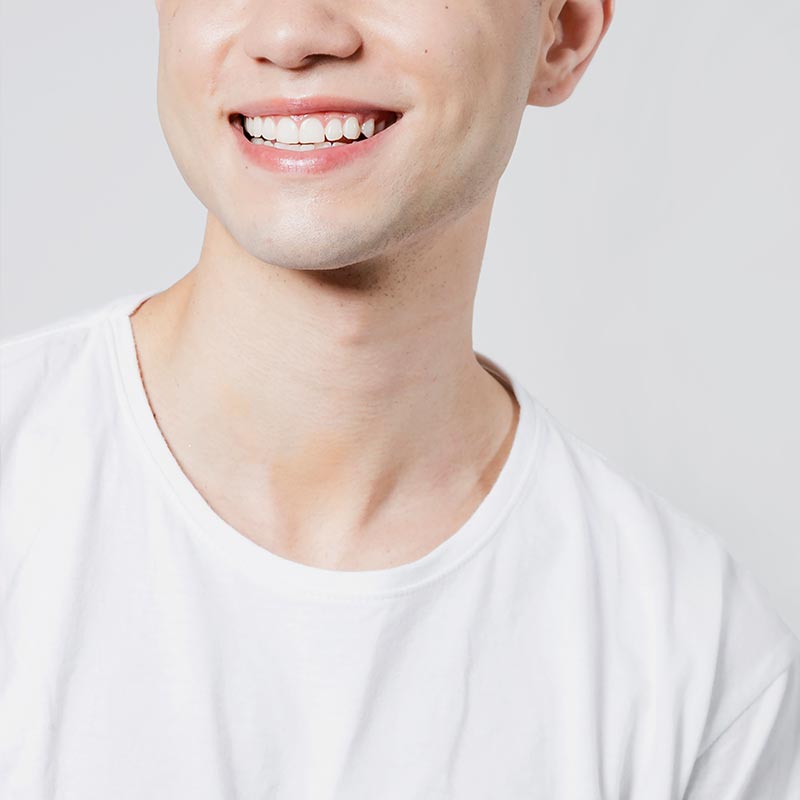 diseño-de-sonrisa-en-jalon-2 Diseño de sonrisa en Jalón